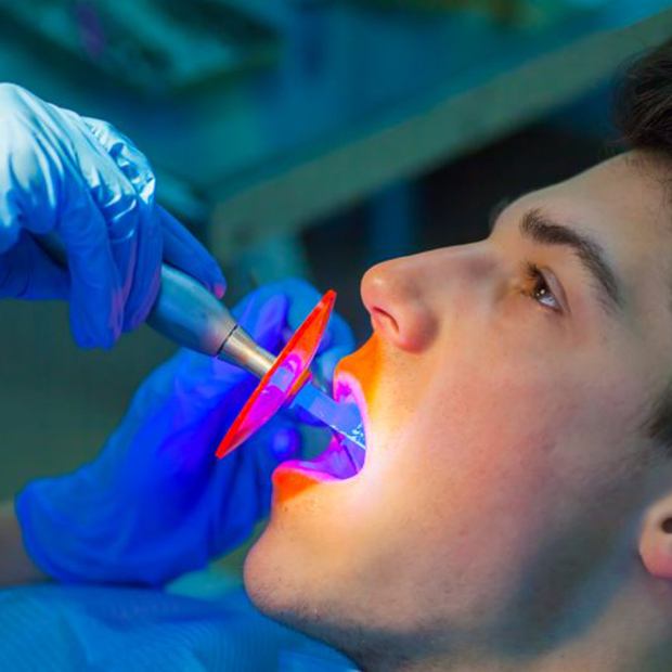 Gloved hands using curing light to harden dental bonding
