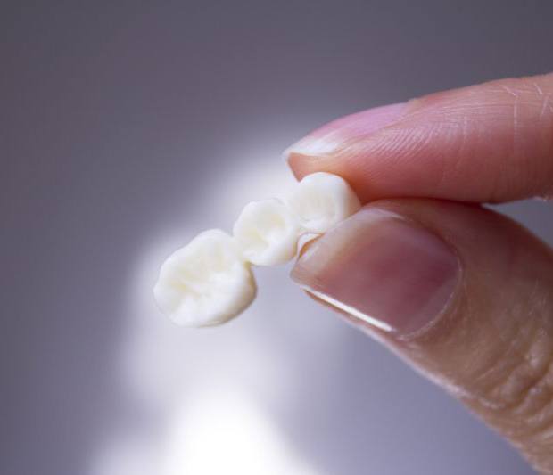 Thumb and forefinger holding a three-unit dental bridge