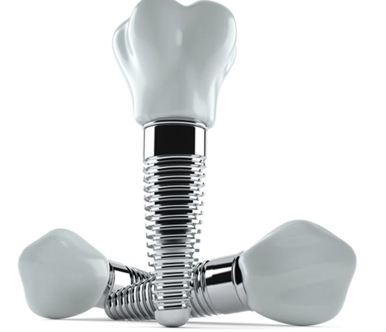 Three dental implants with crowns against white background