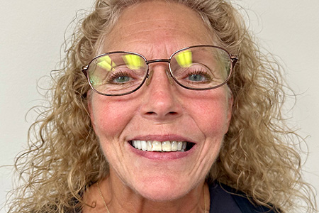 Woman with severely damaged teeth